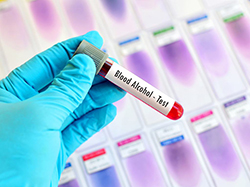 盐城隐私亲子鉴定办理流程，盐城隐私亲子鉴定多少钱